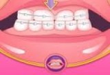 العاب تركيب تقويم الاسنان عند الطبيب